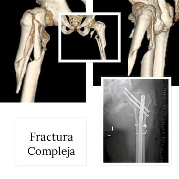 Slider image (2) Dr. Rodrigo Aguirre Rojas Orthopedic Surgeon in Mexico